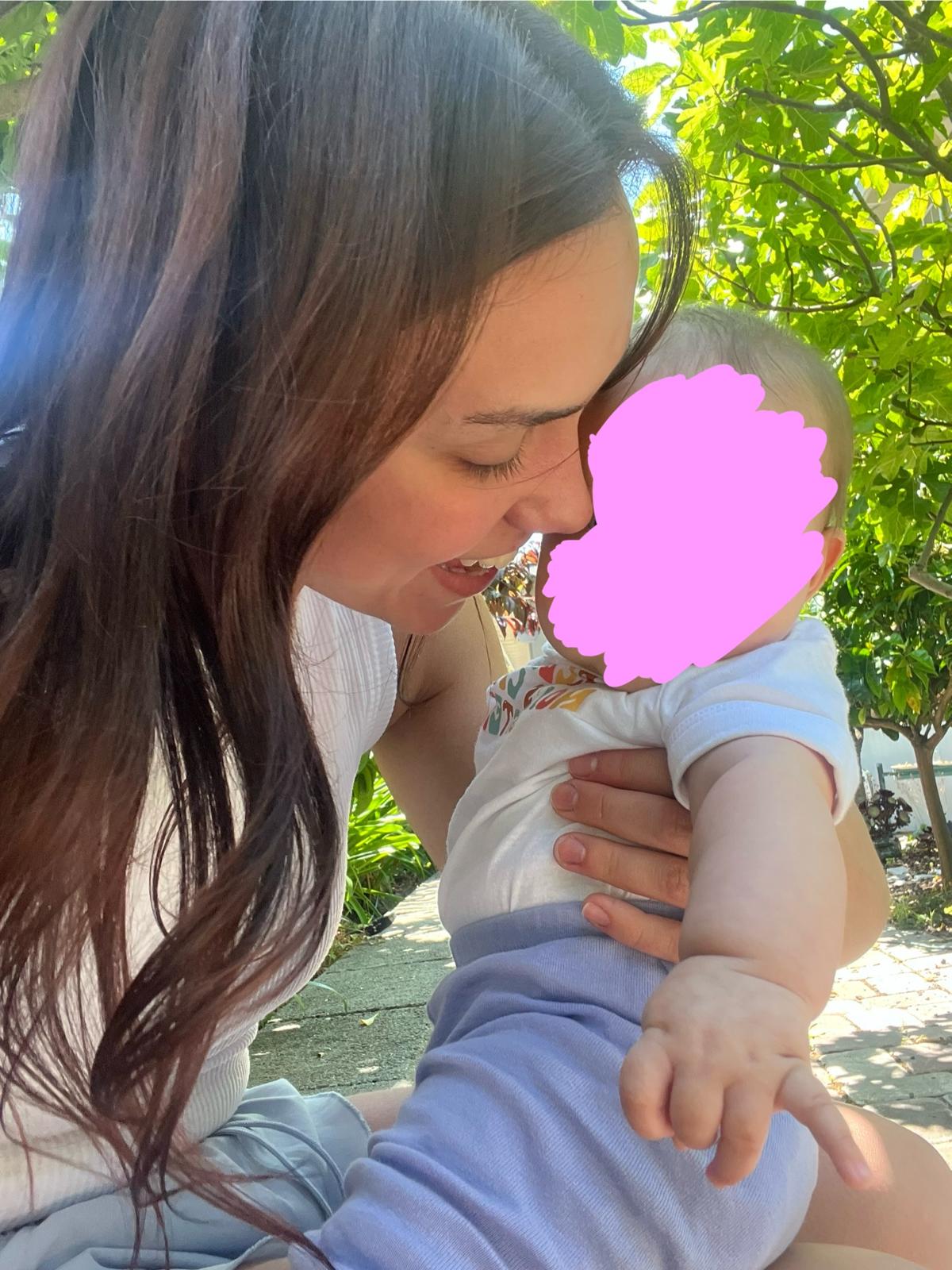 Aurora Carlin Martini holding a baby outdoors under a fig tree, leaning in towards the baby, whose face is covered by a large pink mark.