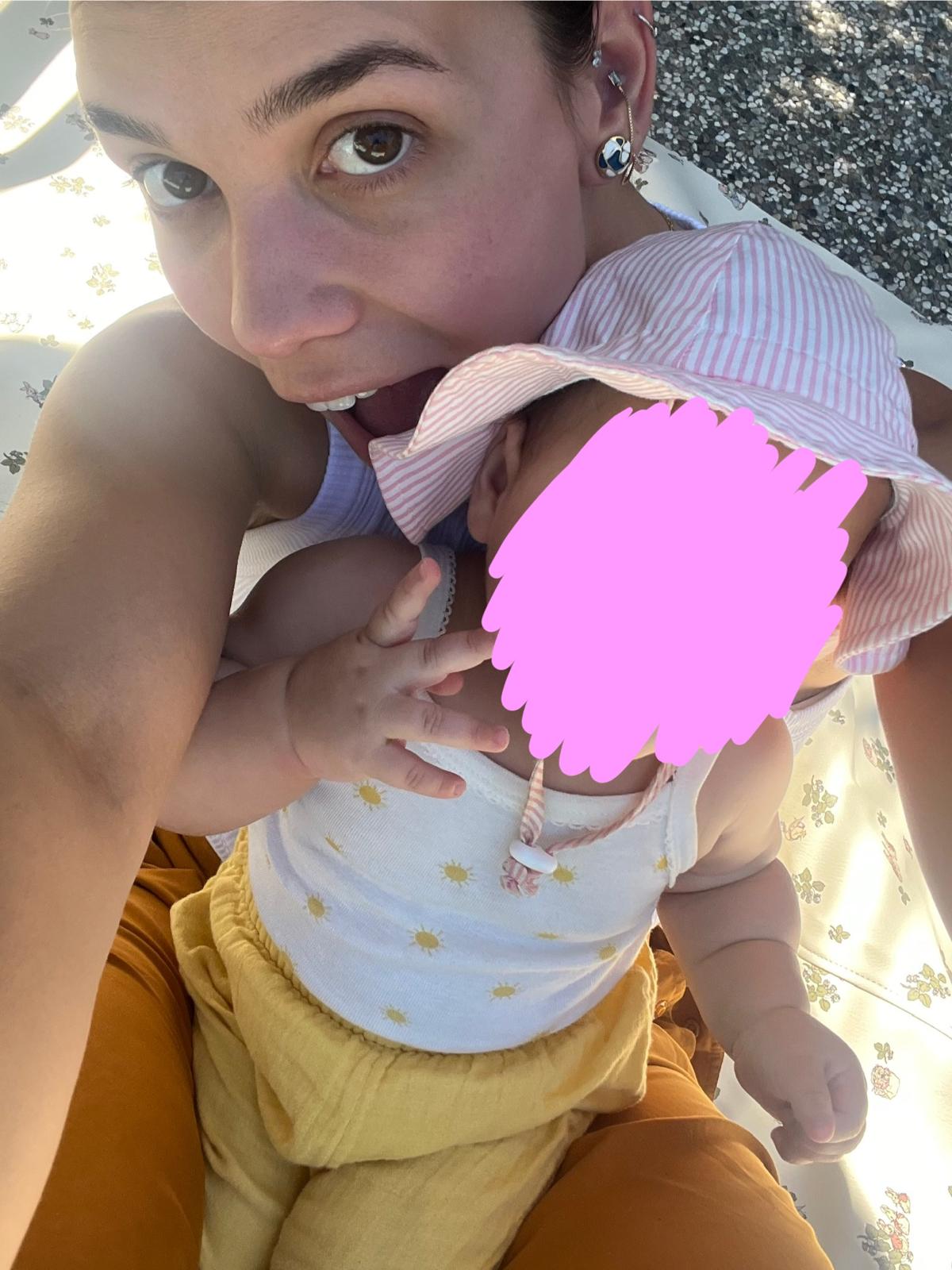 Aurora Carlin Martini holding a baby in a striped sun hat on a picnic blanket, the baby’s face covered by a large pink mark.